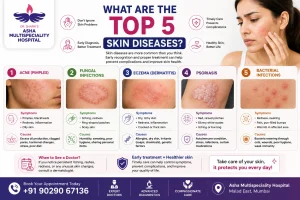 What Are the Top 5 Skin Diseases?